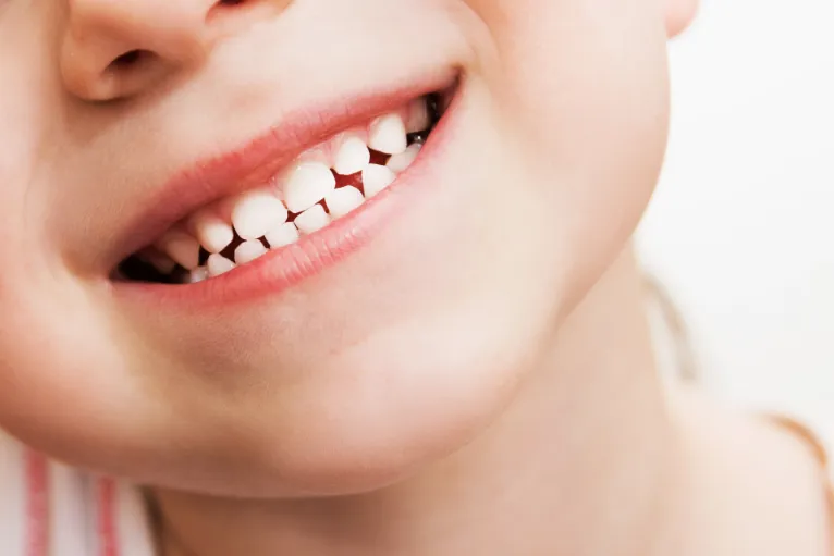 baby-teeth-tempe-az