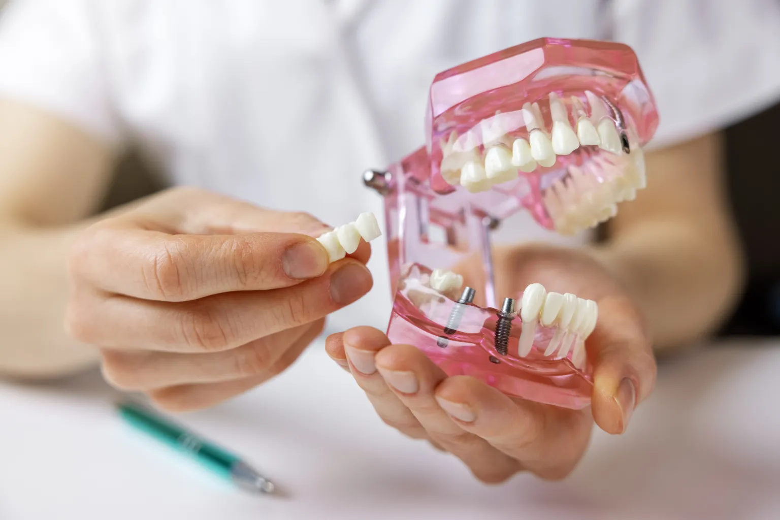 dental-bridge-tempe-az