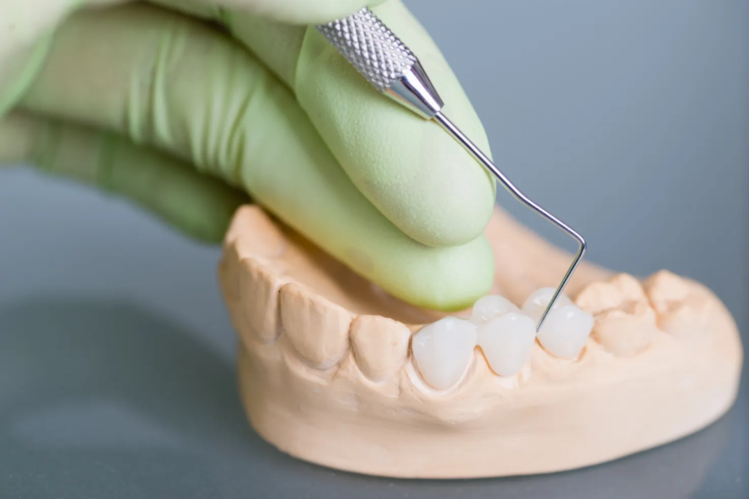 dental-crown-tempe-az