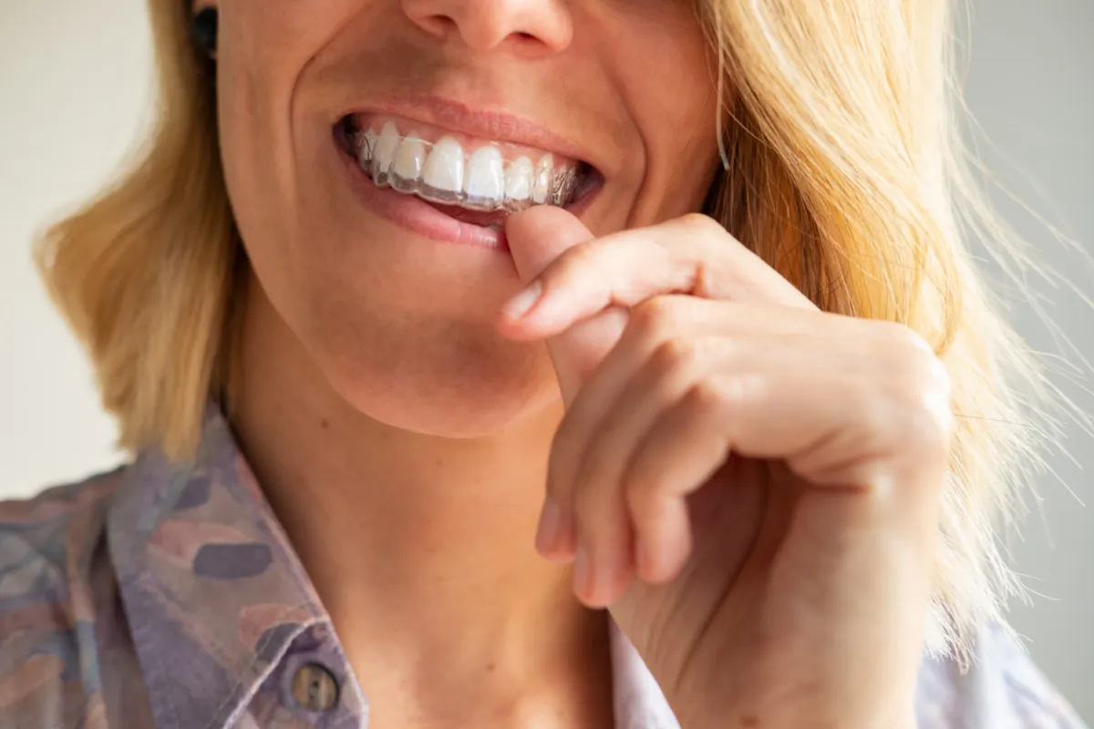invisalign-tempe-az